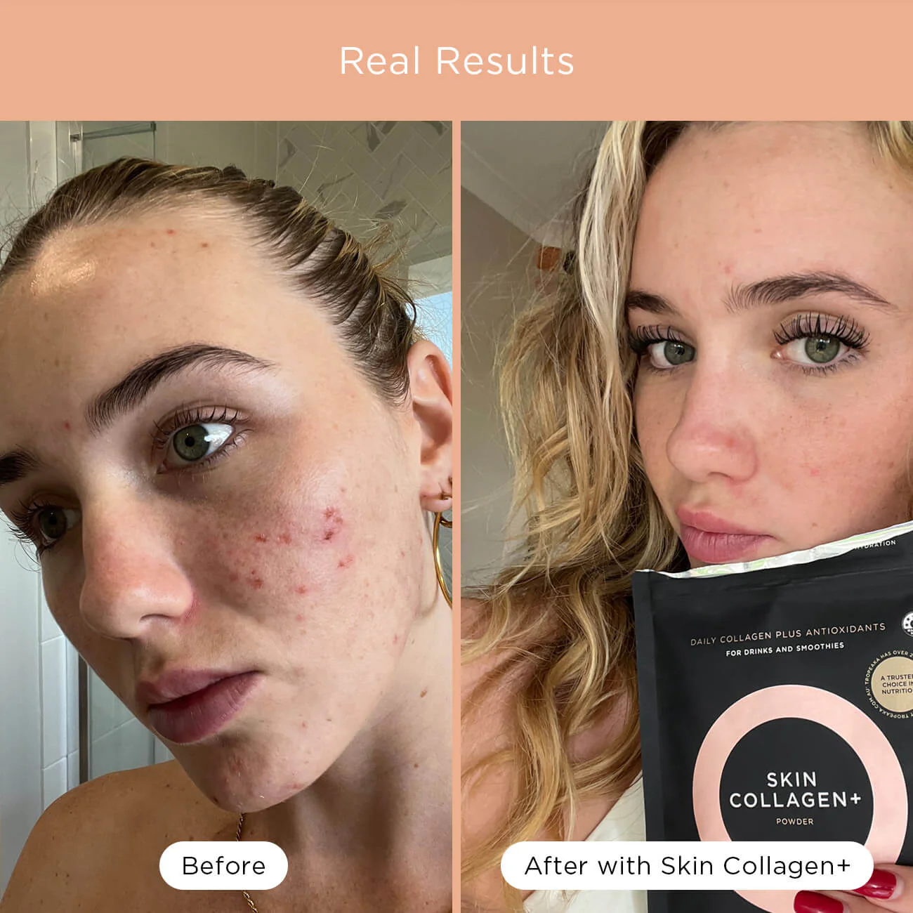 SKIN COLLAGEN+ - Image 4